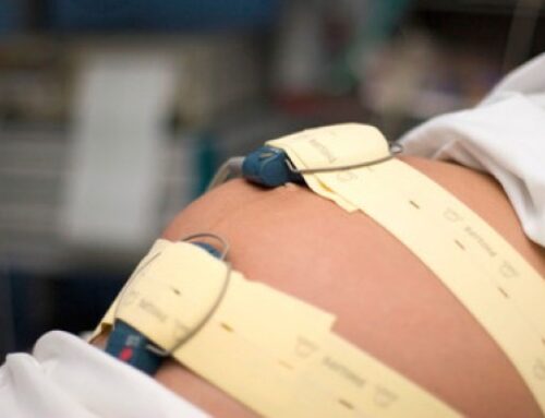 Benessere fetale in travaglio: come interpretare il tracciato cardiotocografico
