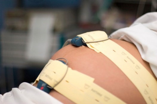 Benessere fetale in travaglio: come interpretare il tracciato  cardiotocografico