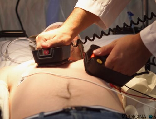 Cardioversione elettrica: una scossa contro la fibrillazione atriale!